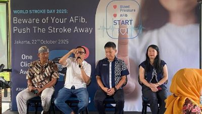 Detak Jantung Tidak Teratur, Sinyal Bahaya Stroke Dini